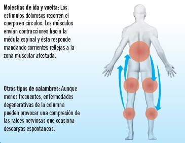 Calambres Musculares: Consejos Para Evitarlos