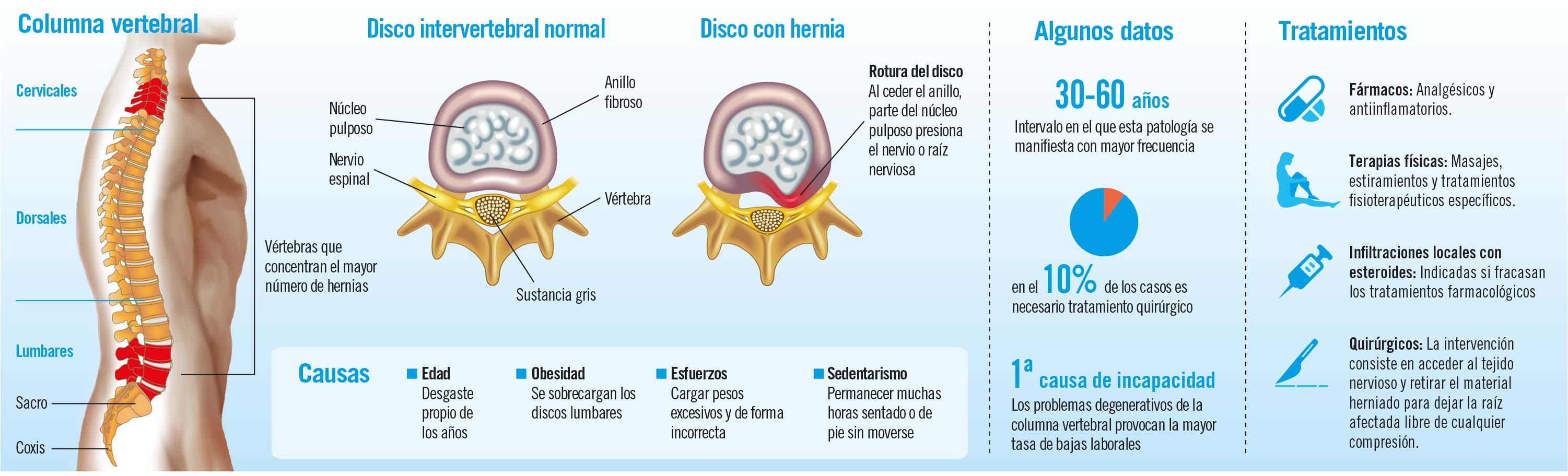 hernia discal lumbar infografía