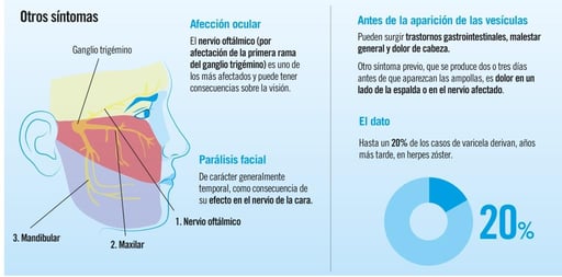 Varicela en adultos: herpes zóster