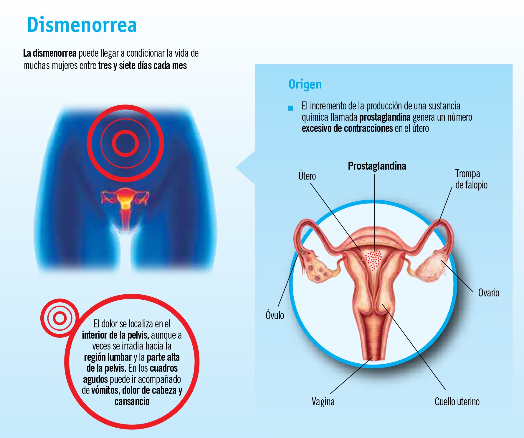 Dolor menstrual: molesto pero fácil de aliviar
