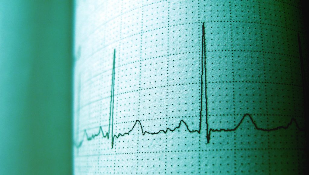 ¿A partir de qué edad hay que hacerse un electrocardiograma?