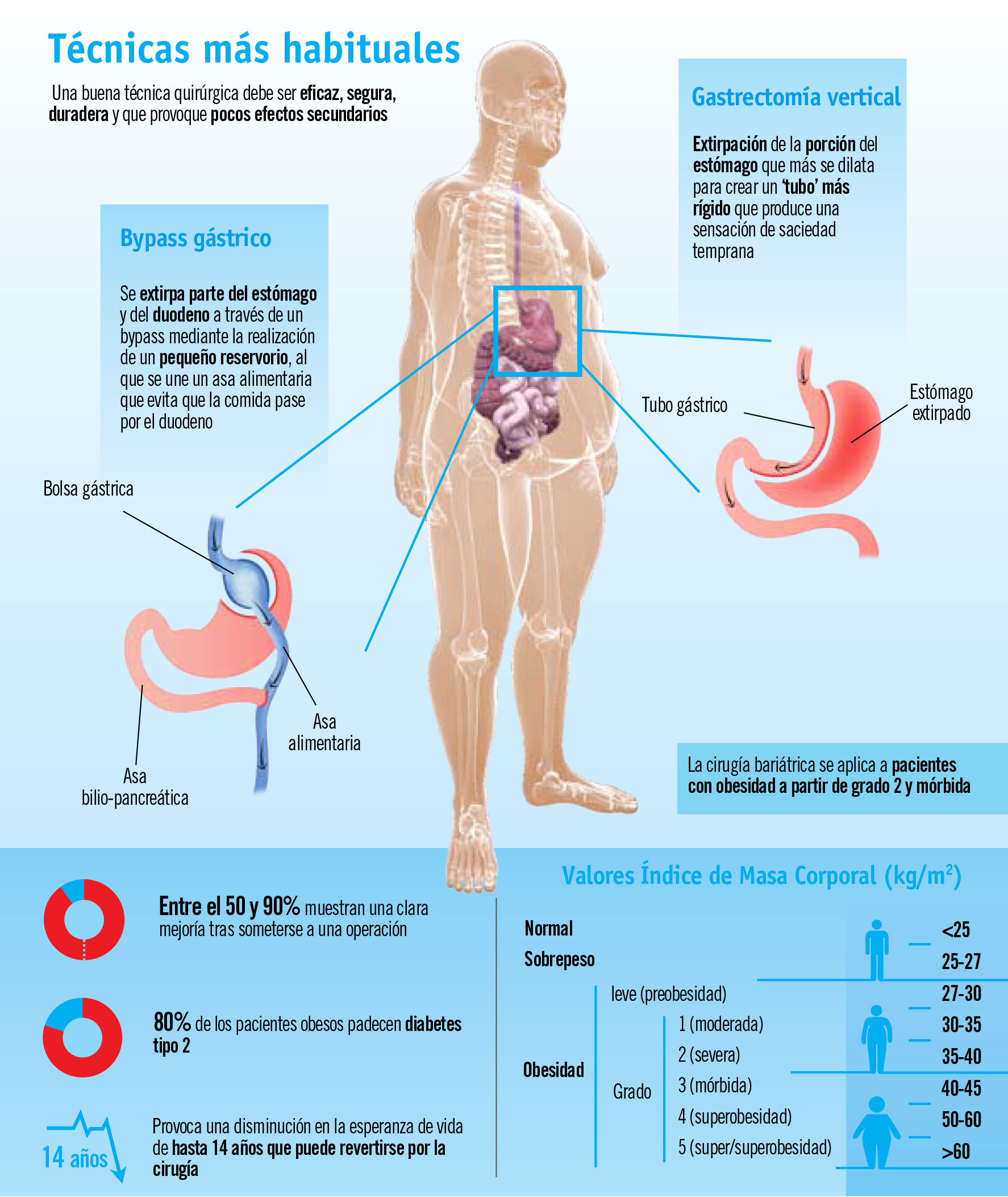 Cirugía bariátrica frente a la obesidad mórbida