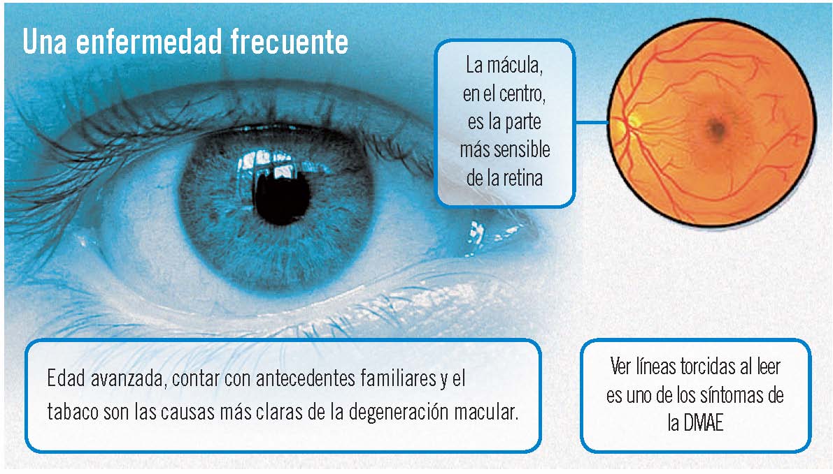 Degeneración macular: prevención a la vista