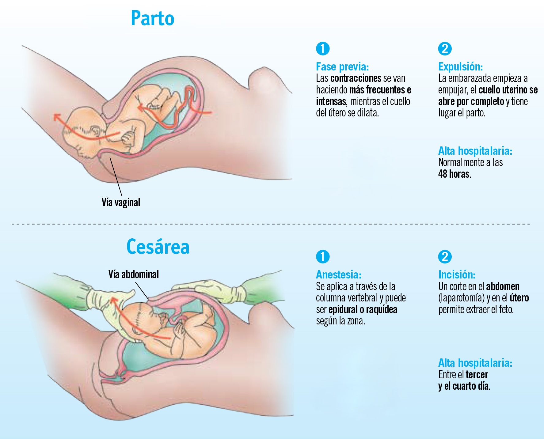 Parto natural o cesárea, una decisión en cada caso