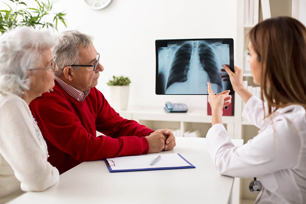 Cáncer de pulmón riesgos de una detección tardía