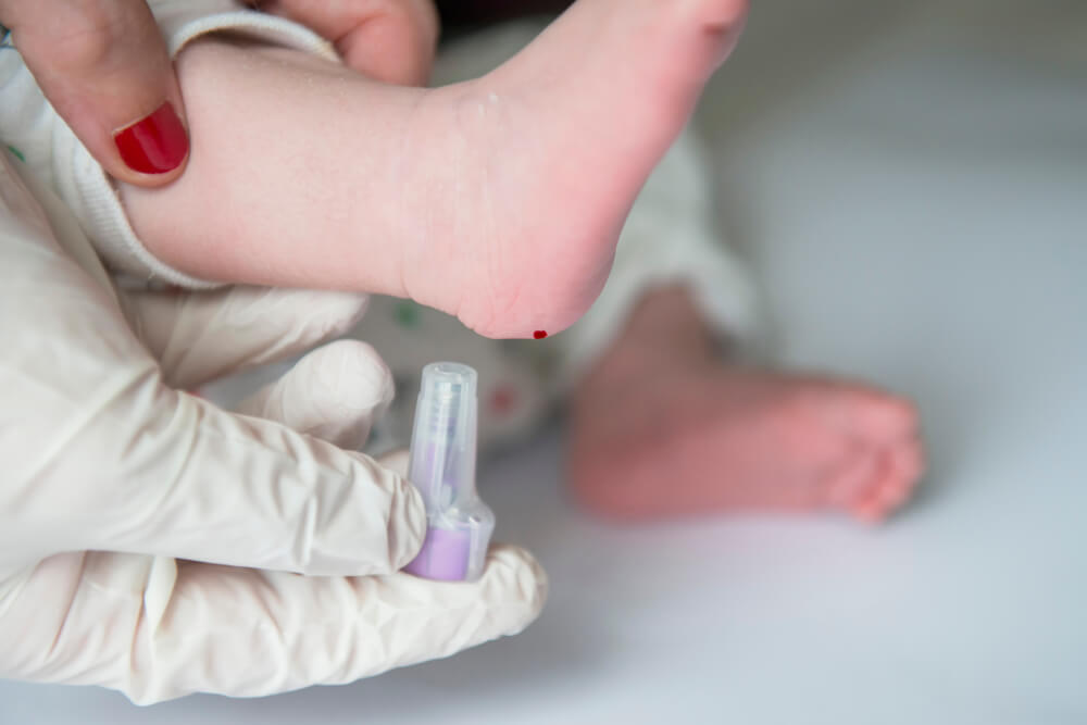 ¿Para qué sirve la prueba del talón en el bebé?