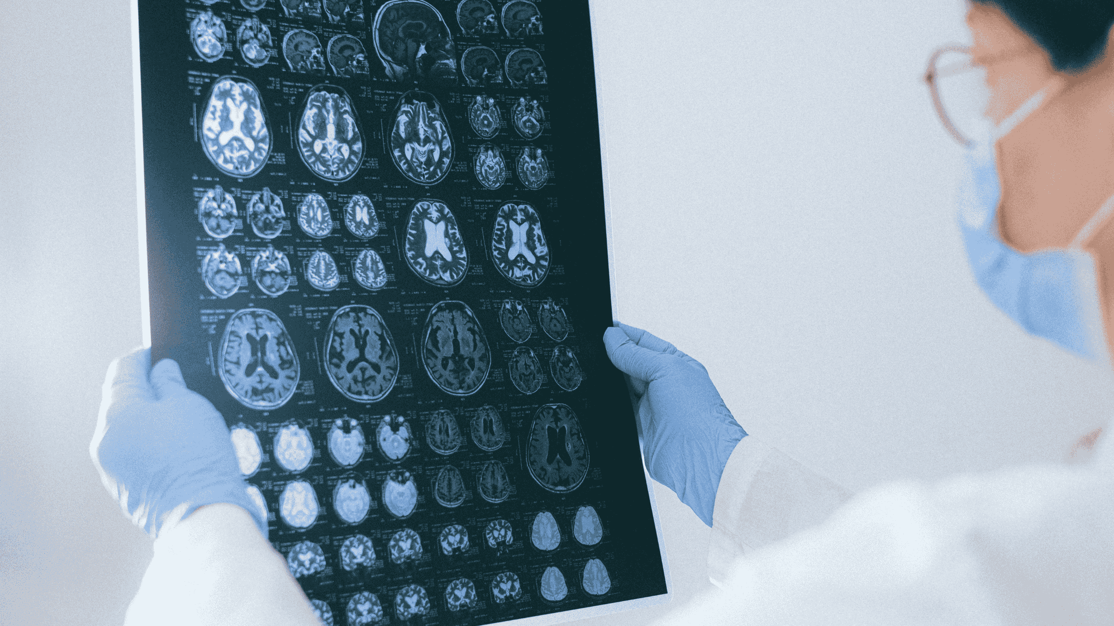 neurocirujano revisa una radiografía de traumatismo craneoencefálico